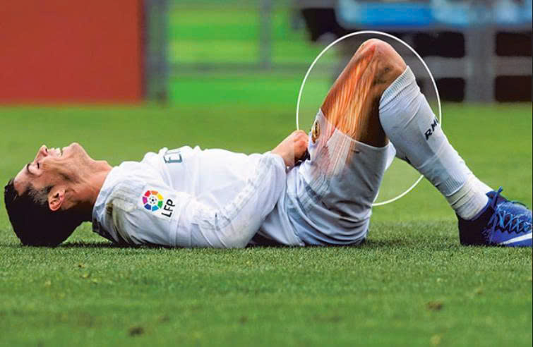 Chấn thương dây chằng đầu gối: Hiểu, điều trị và phục hồi an toàn -